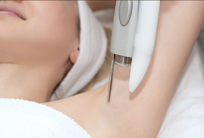 Permanent laser hair removal treatment at Essential Aesthetics & Wellness MedSpa in Chantilly, VA for smooth, hair-free skin