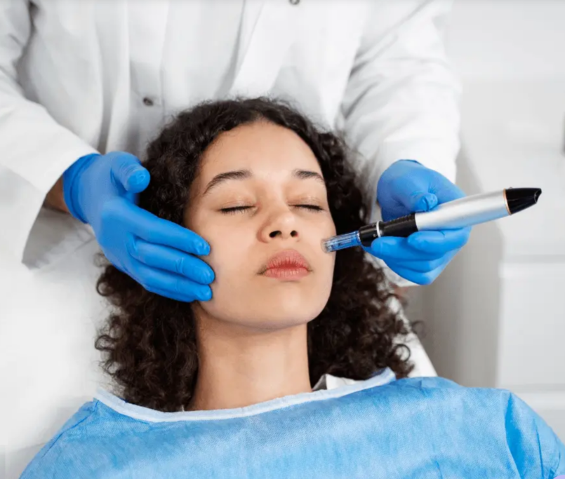 Microneedling treatment for skin rejuvenation at Essential Aesthetics & Wellness MedSpa in Chantilly, VA.