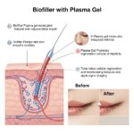 biofiller with plasma gel
