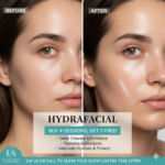 B4G2 HYdrafacial in CHantilly