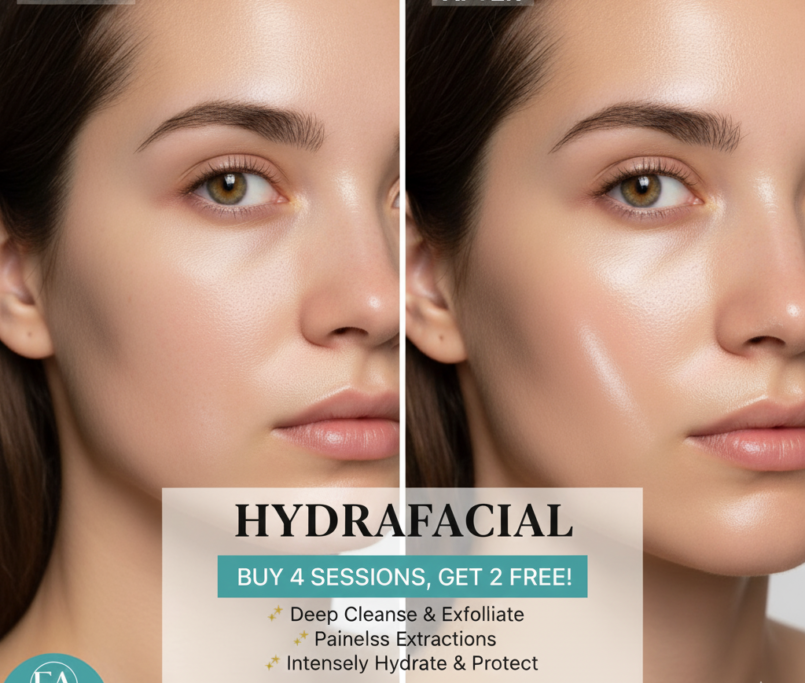 B4G2 HYdrafacial in CHantilly