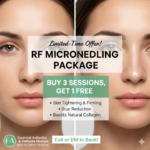 RF Microneedling Offer in Chantilly