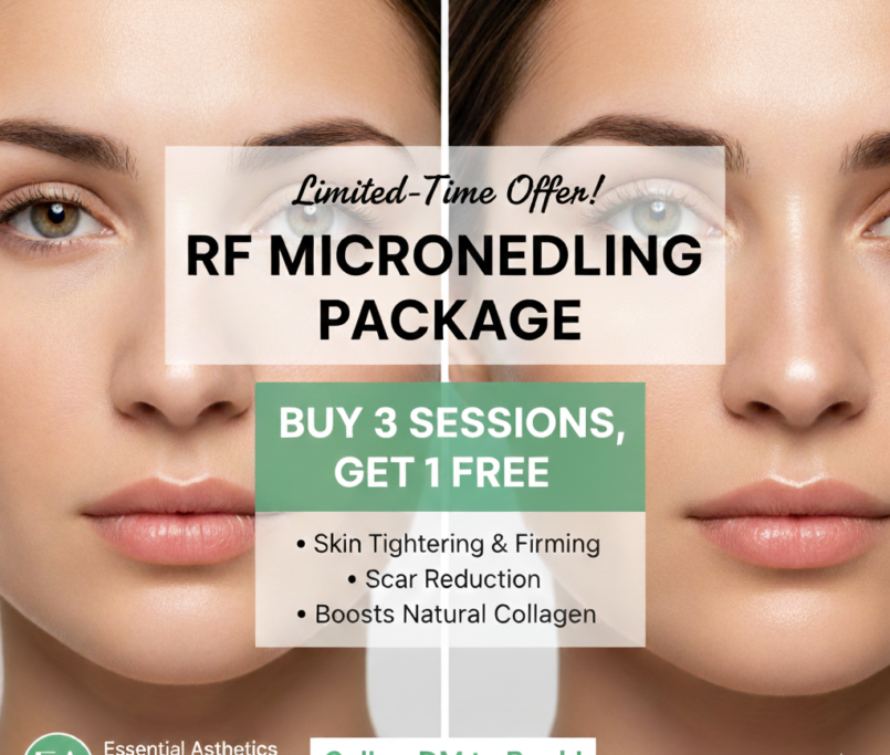 RF Microneedling Offer in Chantilly