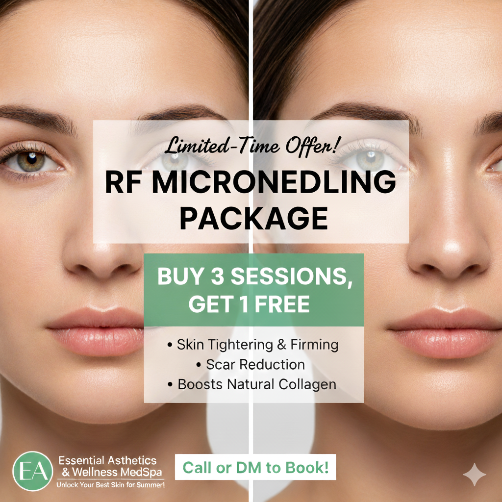 RF Microneedling Offer in Chantilly